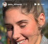 Jesta Hillmann dévoile des photos de son ancien sourire - Instagram