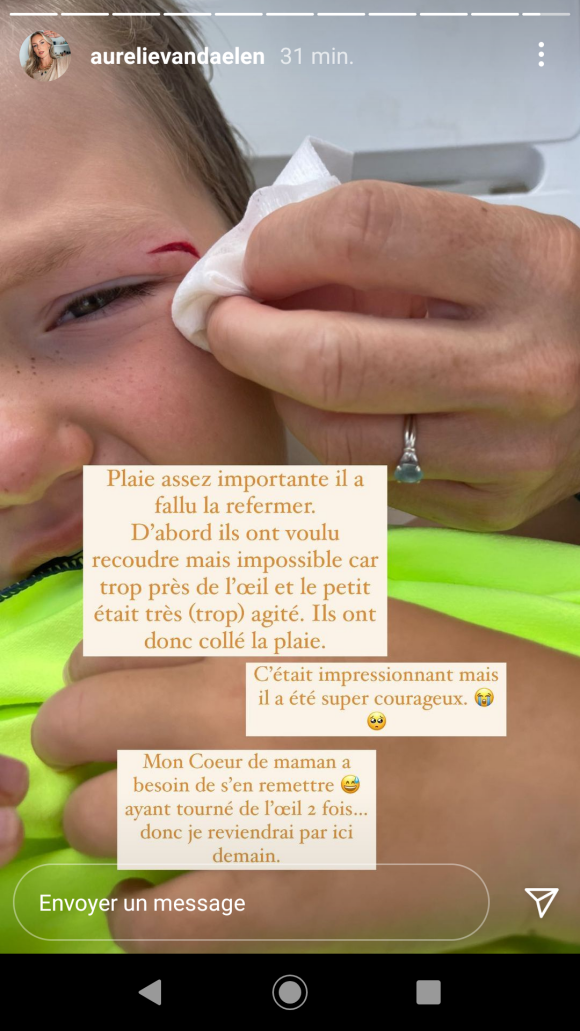 Aurélie Van Daelen révèle en story Instagram que son fils Pharell s'est blessé, le 2 août 2021