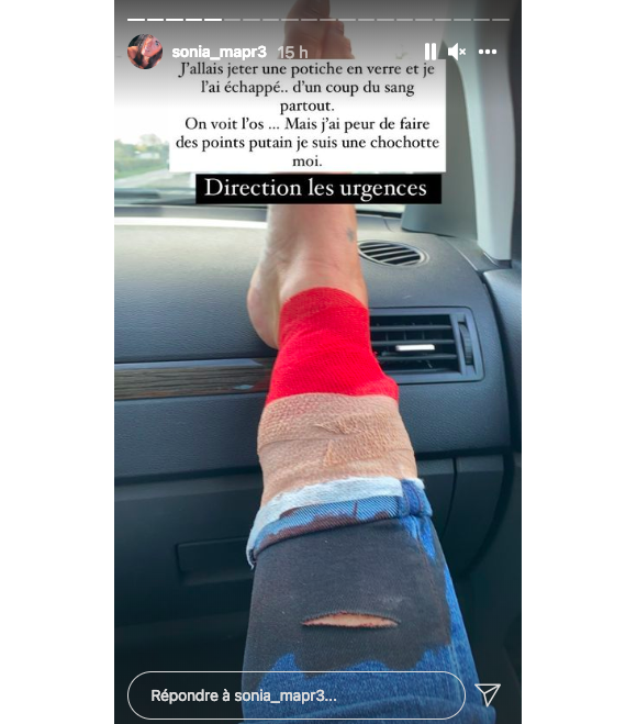 Sonia, candidate de "Mariés au premier regard 2019" s'est blessée à la jambe. Elle a dû se rendre à l'hôpital et avoir des points de suture.