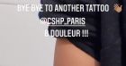 Thylane Blondeau se fait retirer un tatouage au laser