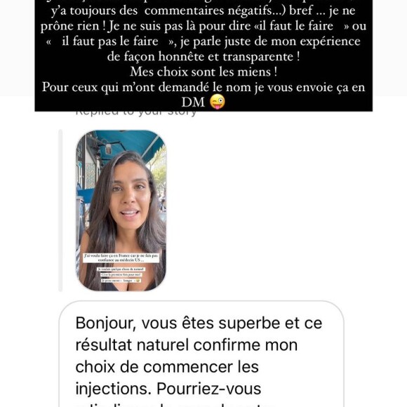 Chloé Mortaud a eu recours au botox, elle se confie sur Instagram