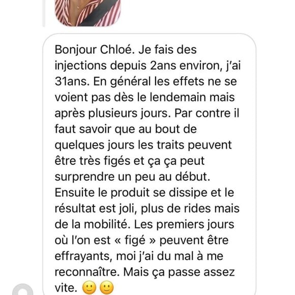 Chloé Mortaud a eu recours au botox, elle se confie sur Instagram