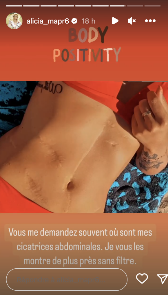 En story Instagram, la femme de Bruno a partagé une photo d'elle en maillot de bain deux pièces, zoomée sur son ventre pour mieux découvrir ses séquelles physiques.
Alicia (Mariés au premier regard) dévoile ses cicatrices au ventre causées par son accident de voiture. Instagram