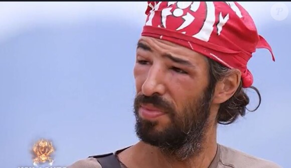 Esteban méconnaissable dans "Koh-Lanta", sur TF1