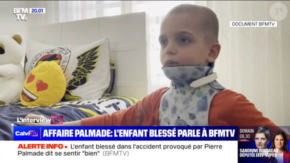 Le petit garçon est marqué à vie par des cicatrices.
Devrim, "BFMTV".