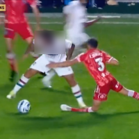 VIDEO Une star du foot provoque une blessure terrifiante en plein match, des images qui font froid dans le dos...