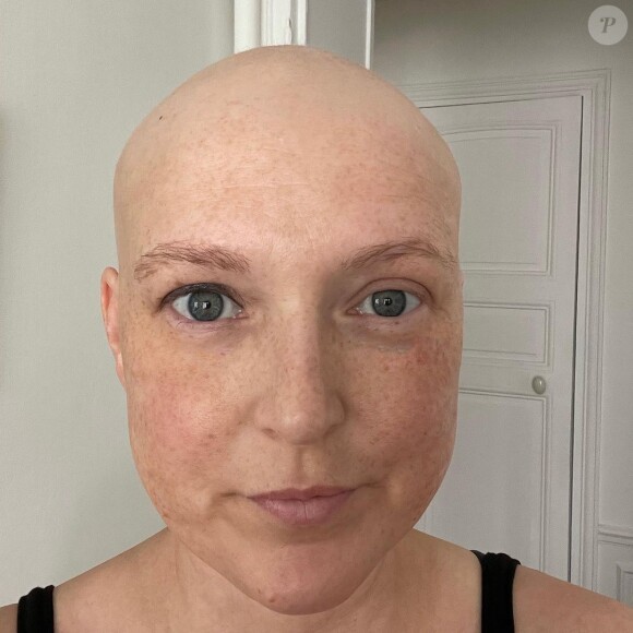 Marion, candidate de "Chacun son tour", atteinte d'un cancer du sein triple négatif.