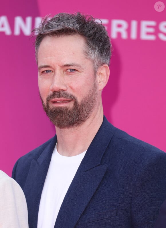 Notamment à un détail sur sa vie privée.
Emmanuel Moire - Soirée d'ouverture de la 7ème saison de "CanneSeries" à Cannes le 5 avril 2024. © Denis Guignebourg/Bestimage 