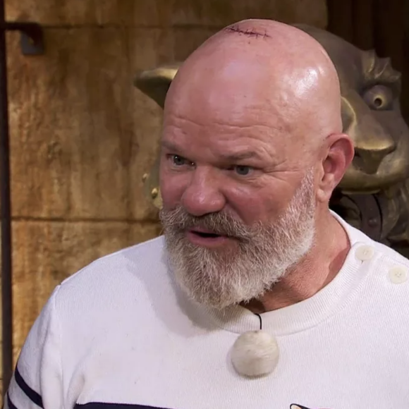 Philippe Etchebest ressort blessé à la tête suite à une épreuve dans "Fort Boyard". M6