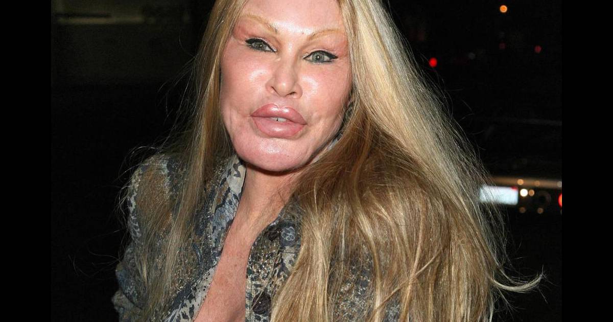 Jocelyn Wildenstein Incroyable La Femme Chat A Retrouve Un Visage Normal Purepeople