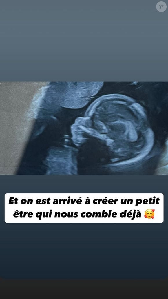 Échographie de Noémie, compagne de l'agriculteur Guillaume de L'amour est dans le pré saison 17 ©Noémie Ocr