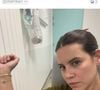 Souailla, la femme de Jimmy Mohamed, partage des images de ses bras couverts de bleus.