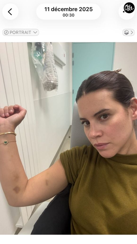 Souailla, la femme de Jimmy Mohamed, partage des images de ses bras couverts de bleus.