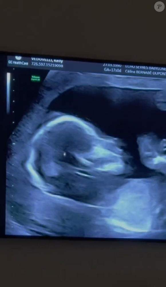 Capture instagram @kellyvedovelli