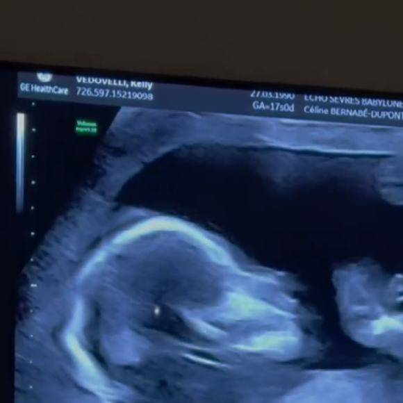 Capture instagram @kellyvedovelli