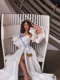PORTRAIT Miss France 2026 : Noémie Baiamonte (Miss Rhône-Alpes 2025) a une particularité physique autorisée depuis seulement 3 ans !