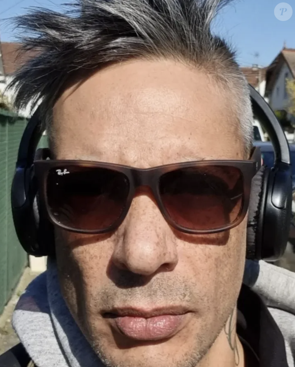 En effet, ce dernier est apparu blessé suite à un accident.

Georges-Alain Jones sur Instagram.