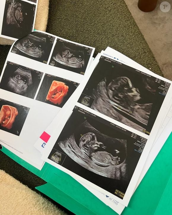 Margaux Lignel, la femme d'Arnaud Bonet, a publié de nombreuses photos de l'annonce de sa grossesse sur Instagram.