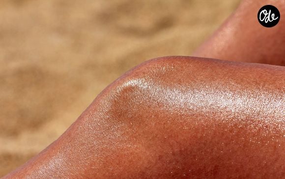 Une dermatologue alerte sur la banalisation des coups de soleil partagés sur les réseaux sociaux.