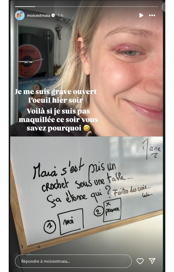 Maïa de la "Star Academy" dévoile sa blessure à l'oeil en story Instagram, le 8 mai 2025