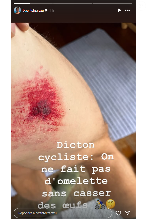 Sur les images, il montre d'une part le haut d'une de ses cuisses, grandement éraflée

Bixente Lizarazu annonce s'être blessé à vélo.