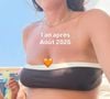 Quinze mois après son deuxième accouchement, elle revient sur l'évolution de son corps.

Loulou Kitchen a partagé l'évolution de son corps suite à son accouchement. Capture d'écran Instagram
