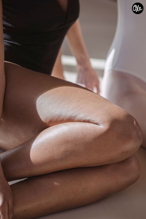Ce phénomène est principalement causé par une insuffisance veineuse et une dilatation des vaisseaux sous l'effet de la chaleur.