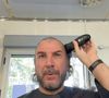 "J'ai tendance, pour passer mon stress, comme là par exemple, à prendre un poil de la barbe et à tirer dessus et à me faire des trous dans la barbe, des trous dans les poils du torse, des trous dans les cheveux.”

Michaël Youn s'affiche crâne rasé sur les réseaux sociaux