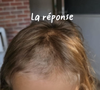 En réalité, Alba s'est rasé une partie des cheveux !

Alba, la fille de Camille Santoro (Familles nombreuses), a fait une bêtise : elle s'est rasé une partie de la tête.