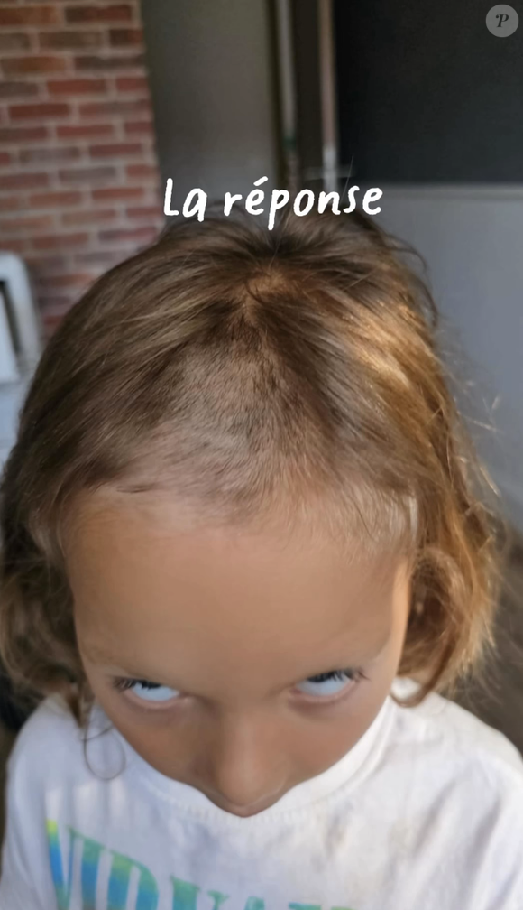En réalité, Alba s'est rasé une partie des cheveux !

Alba, la fille de Camille Santoro (Familles nombreuses), a fait une bêtise : elle s'est rasé une partie de la tête.
