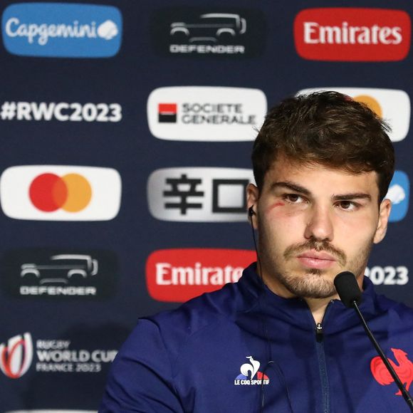 Très attaché à ses racines, Antoine Dupont a repris la métairie de Barthas avec son frère Clément en 2023.

15 octobre 2023, Paris, Seine-Saint-Denis, France : Le Français Antoine Dupont en conférence de presse après le quart de finale de la Coupe du monde de rugby 2023 opposant la France à l'Afrique du Sud. (Credit Image: © Mickael Chavet/ZUMA Press Wire)