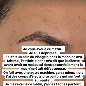 "J'ai fait un soin du visage hier et la machine m'a fait mal, l'esthéticienne m'a dit que la cliente avant avait eu mal aussi donc potentiellement la machine était défectueuse".

Diane Leyre raconte une mauvaise expérience d'esthétique.