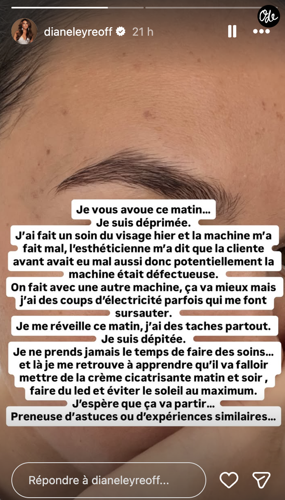"J'ai fait un soin du visage hier et la machine m'a fait mal, l'esthéticienne m'a dit que la cliente avant avait eu mal aussi donc potentiellement la machine était défectueuse".

Diane Leyre raconte une mauvaise expérience d'esthétique.