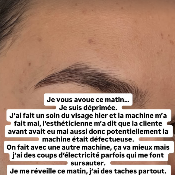 "J'ai fait un soin du visage hier et la machine m'a fait mal, l'esthéticienne m'a dit que la cliente avant avait eu mal aussi donc potentiellement la machine était défectueuse".

Diane Leyre raconte une mauvaise expérience d'esthétique.