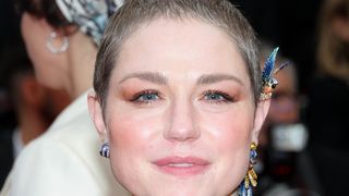 Atteinte d'un corticosurrénalome, pourquoi Emilie Dequenne a-t-elle choisi de le rendre public ? Deux célèbres proches s'expriment