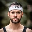 Cyril (Koh-Lanta) s'en est remis à une prestigieuse clinique à Paris pour effacer les stigmates de ce qui lui est arrivé il y a 10 ans