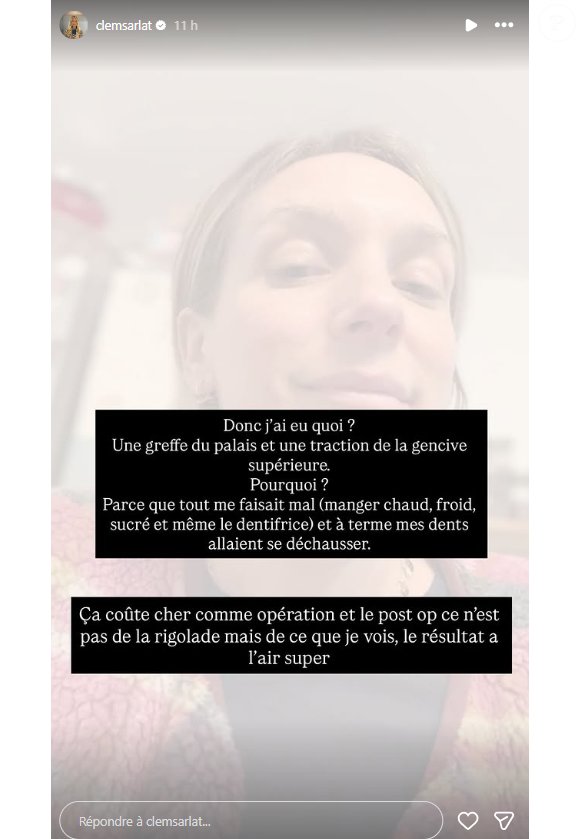Clémentine Sarlat annonce avoir subi une opération.