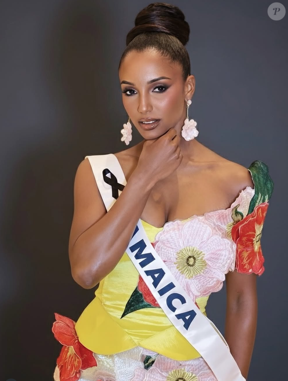 Lors d'une soirée des préliminaires de Miss Univers, Gabrielle Henry a fait une lourde chute qui l'a conduite à l'hôpital.

Capture d'écran du compte Instagram de Gabrielle Henry