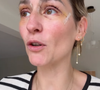 Elle a eu recours à un lifting mammaire ainsi qu'à une blépharoplastie des paupières.

Laure (Mariés au premier regard) donne des nouvelles après ses opérations de la poitrine et des paupières, sur Instagram le 15 septembre 2025.