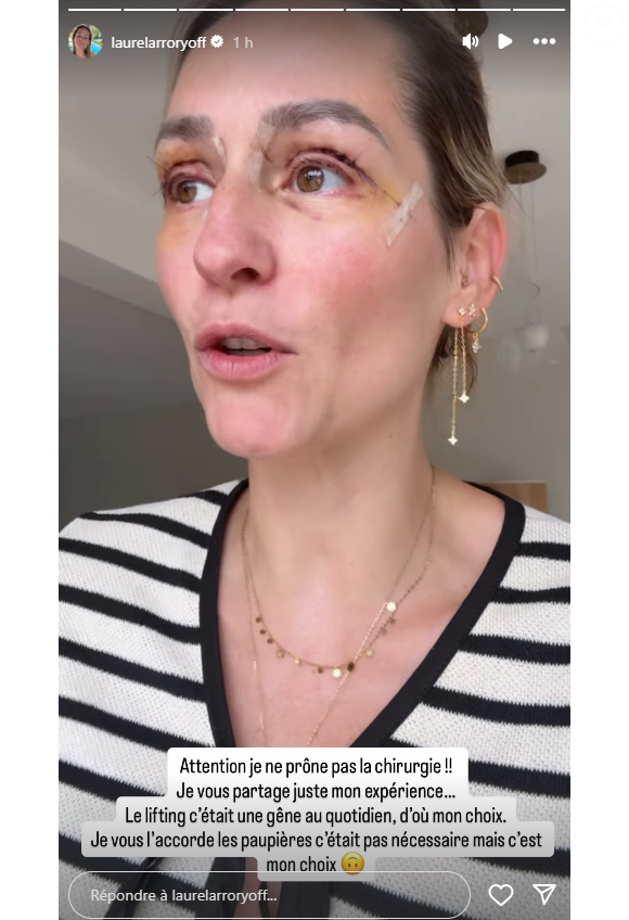 Elle a eu recours à un lifting mammaire ainsi qu'à une blépharoplastie des paupières. Laure (Mariés au premier regard) donne des nouvelles après ses opérations de la poitrine et des paupières, sur Instagram le 15 septembre 2025.