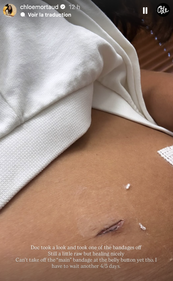 Après son rendez-vous médical, elle a toutefois partagé une seconde image, où elle apparaît avec beaucoup moins de pansements.
