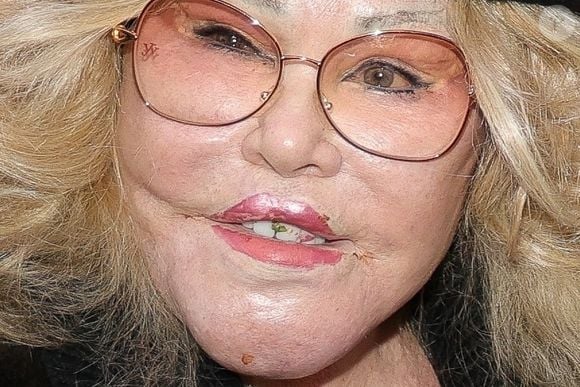 info - Jocelyne Wildenstein: la femme "chat" est décédée à Paris d’une embolie pulmonaire - Jocelyne (Jocelyn) Wildenstein avec un morceau de salade entre les dents.