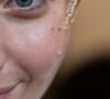 Heureusement, des soins dermocosmétiques ciblés permettent de corriger efficacement le teint.