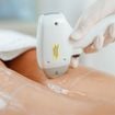 Épilation laser ou électrique : Quelle méthode est la meilleure pour se débarrasser définitivement de vos poils ?
