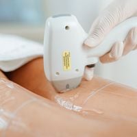 Épilation laser ou électrique : Quelle méthode est la meilleure pour se débarrasser définitivement de vos poils ?