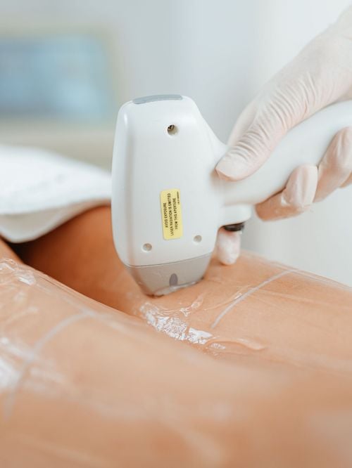 Épilation laser ou électrique : Quelle méthode est la meilleure pour se débarrasser définitivement de vos poils ?