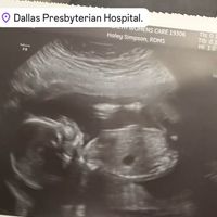 Une figure phare de BFMTV va accueillir son premier enfant, voyage jusqu'aux États-Unis pour découvrir son bébé avec l'échographie des 5 mois