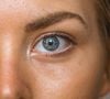 Le gonflement des yeux est causé par une inflammation ou une accumulation de fluides dans les tissus entourant l'œil.