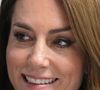 Depuis qu'elle est officiellement en rémission de son cancer, Kate Middleton multiplie les apparitions en public.

Kate Middleton rencontre des joueurs blessés, en marge du match du tournoi des Six Nations entre le Pays de Galles et l'Angleterre à Cardiff, le 15 mars 2025.

Photo : Julien Burton / Bestimage