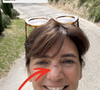 "La porte 1 - Estelle 0", a-t-elle préféré s'en amuser en postant un selfie d'elle en story Instagram.
Estelle Denis se blesse au visage pendant ses vacances avec son compagnon Marc Thiercelin